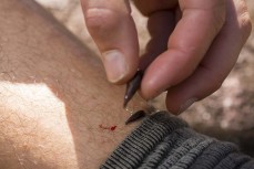 Removing leeches during a three-day mountain biking and hiking trek into Cedar Bay National Park in North Queensland, Australia. 
